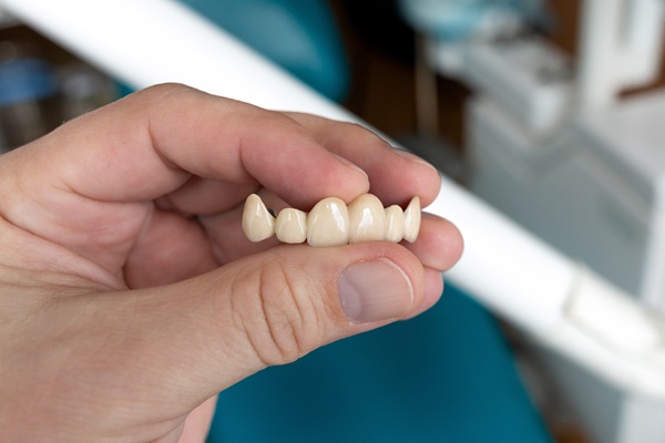 Dental Bridges, Explained: Types, Benefits, And Longevity