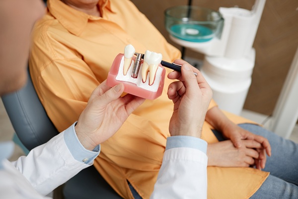 Services Offered By An Implant Dentist