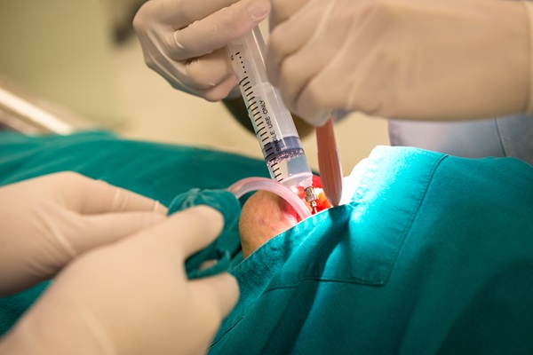 The Most Common Types Of Oral Surgery Procedures
